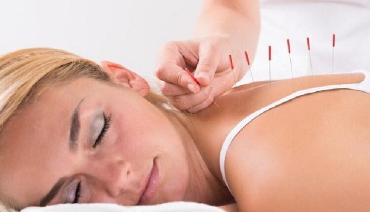 Chinese Medicine